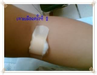 ภาวะปอดติดเชื้อ