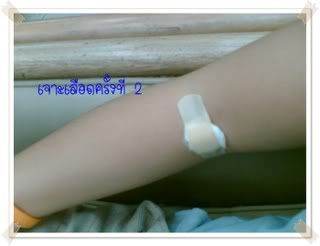 ภาวะปอดติดเชื้อ