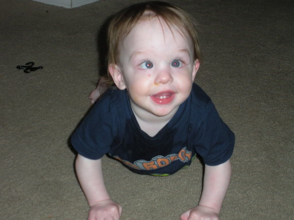 Looks cross eyed BabyCenter